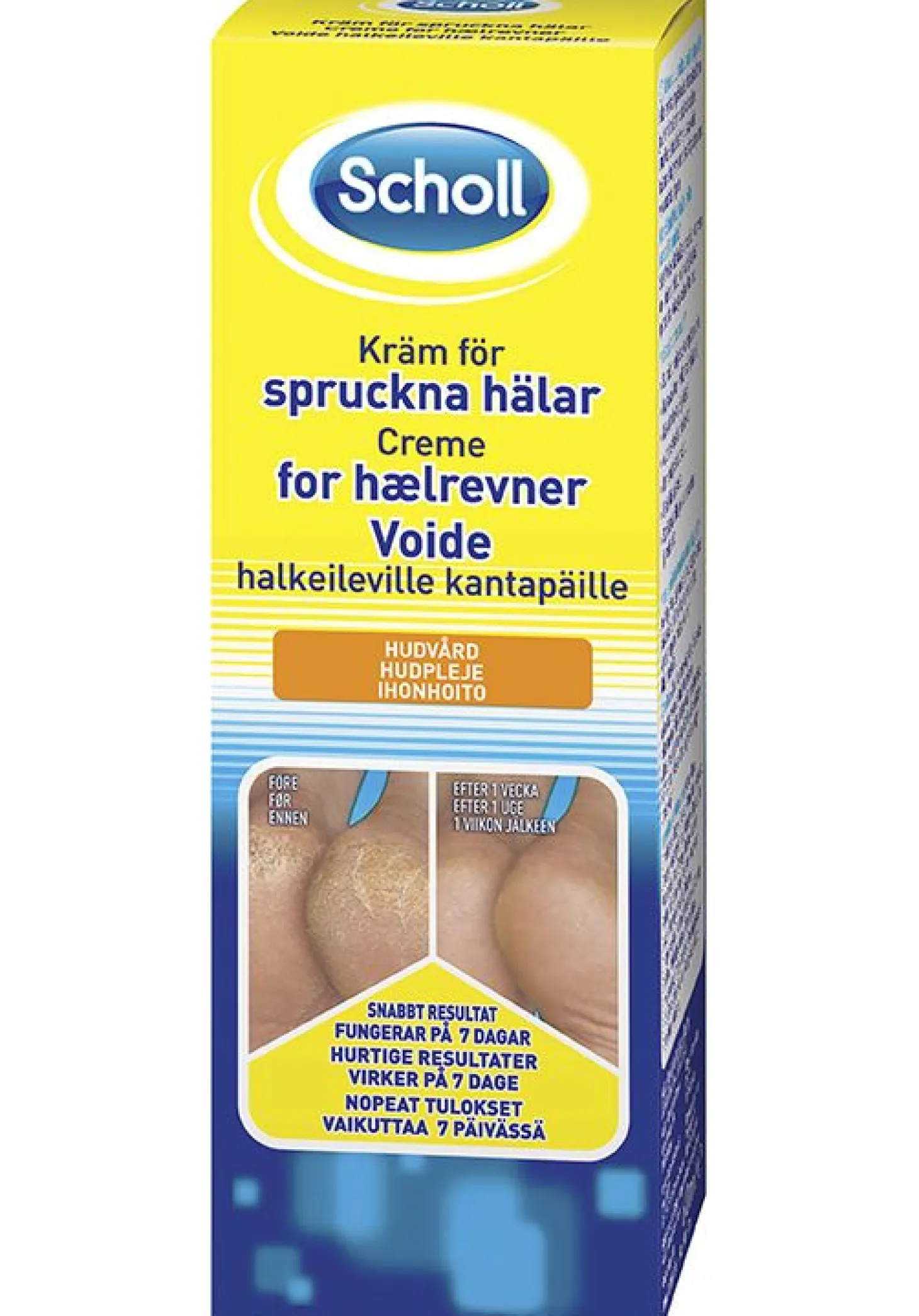 Krem for sprukne hæler